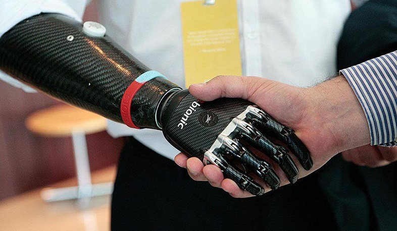 Injured boys will have state-of-the-art prostheses