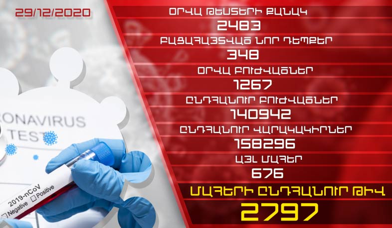 Թարմացում. 29.12.2020. Հաստատվել է կորոնավիրուսի 348 նոր դեպք, առողջացել 1267 մարդ