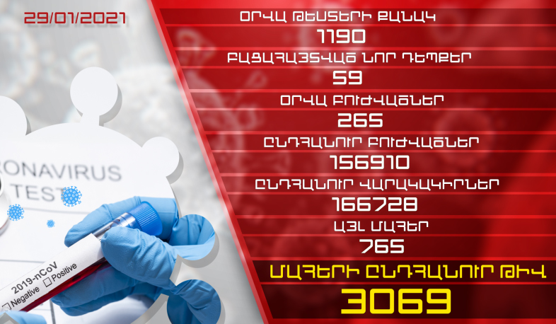Թարմացում. 29.01.2021. Հաստատվել է կորոնավիրուսի 59 նոր դեպք, առողջացել է 265 քաղաքացի