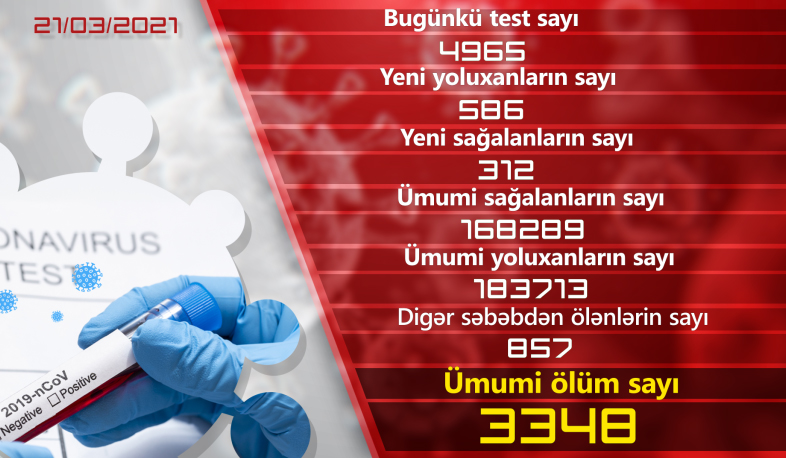 Ermənistanda daha 586 nəfər COVID-19-a yoluxub, 312 nəfər sağalıb