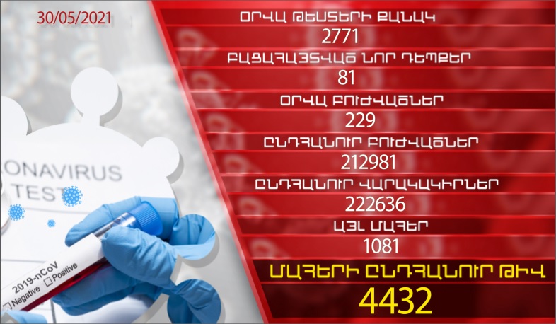 Թարմացում. 30.05.2021. Հաստատվել է կորոնավիրուսի 81 նոր դեպք, առողջացել Է 229 մարդ