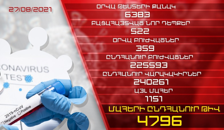 Թարմացում. 27.08.2021. Հաստատվել է կորոնավիրուսի  522 նոր դեպք, առողջացել 359 քաղաքացի