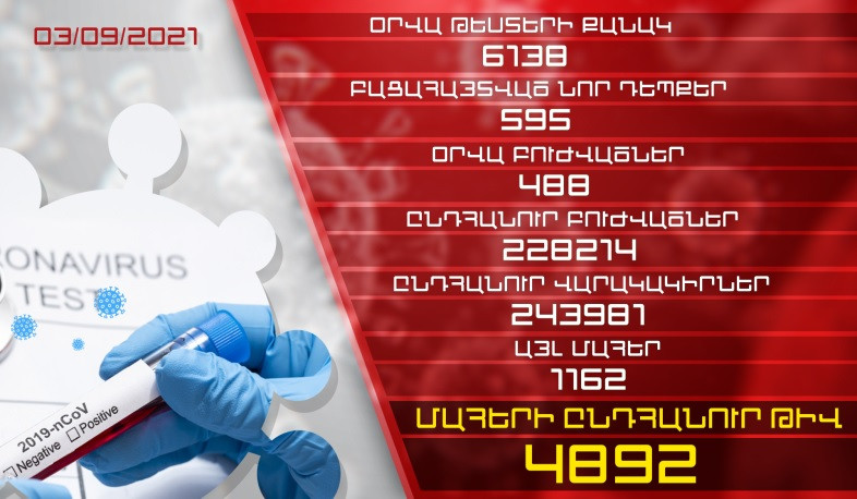 Թարմացում. 03.09.2021. Հաստատվել է կորոնավիրուսի 595 նոր դեպք, առողջացել 488 քաղաքացի