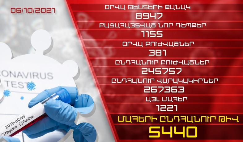 Թարմացում. 06.10.2021. Հաստատվել է կորոնավիրուսի նոր 1155 դեպք, առողջացել 381 քաղաքացի