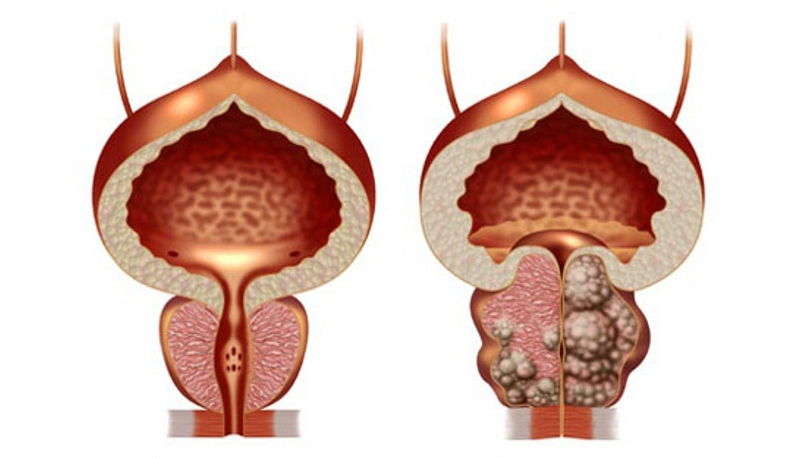 Armenian surgeons conduct prostate surgery