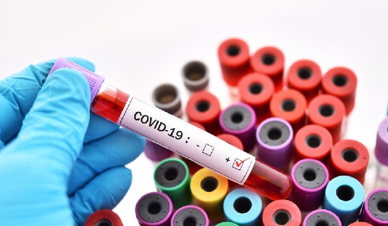 No new case of coronavirus has been confirmed in Artsakh