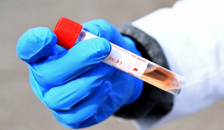 1 new case of coronavirus has been confirmed in Artsakh, 7 more people have recovered
