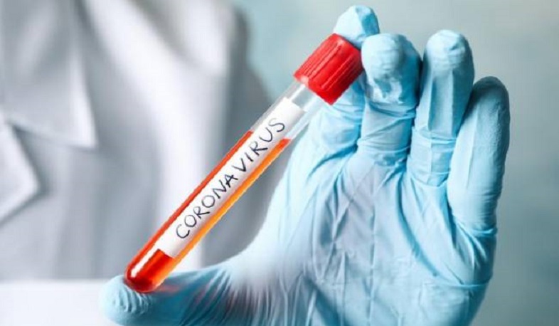 2 new cases of coronavirus have been confirmed in Artsakh, 5 people have recovered