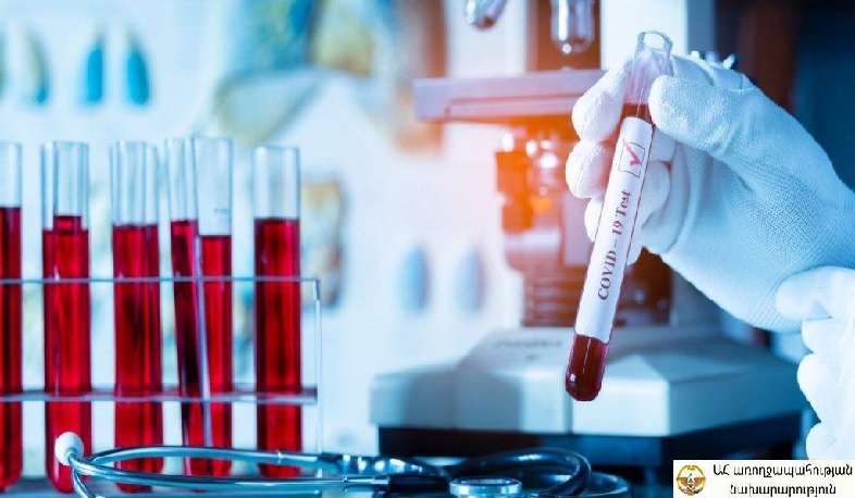 Three new cases of coronavirus confirmed in Artsakh