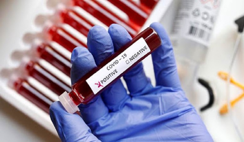 A total of 4233 new cases of coronavirus recorded in Georgia