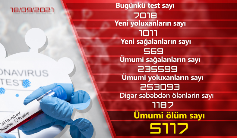 Ermənistanda son sutkada COVID-19-a 1011 yoluxma qeydə alınıb
