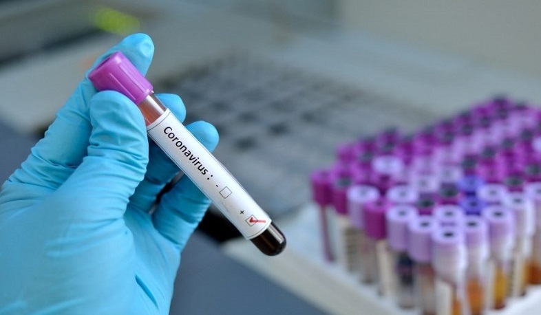 28 cases of coronavirus have been confirmed in Artsakh, 8 recovered