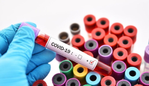 No new case of coronavirus has been confirmed in Artsakh