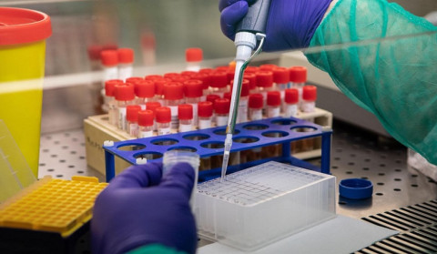 7 new cases of coronavirus have been confirmed in Artsakh