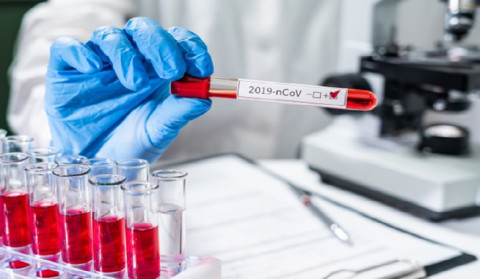 10 new cases of coronavirus have been confirmed in Artsakh