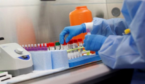 2 new cases of coronavirus disease have been confirmed in Artsakh