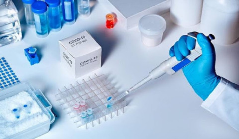 4 new cases of coronavirus have been confirmed in Artsakh