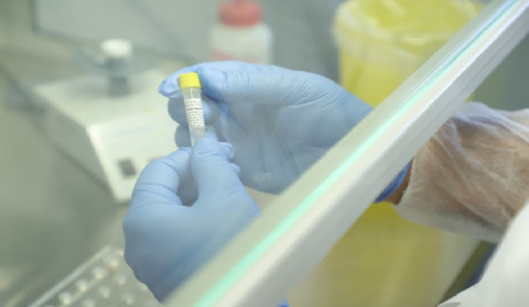 1 new case of coronavirus has been confirmed in Artsakh