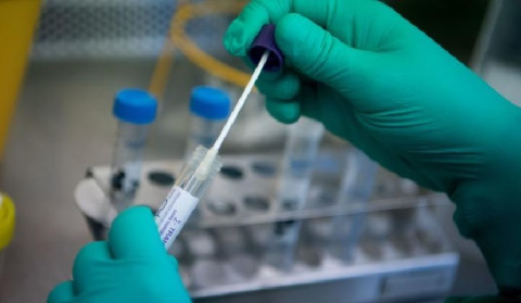 1 new case of coronavirus in Artsakh