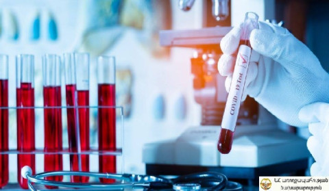 One new case of coronavirus confirmed in Artsakh