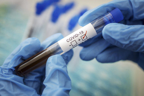 Fifth wave of coronavirus is knocking on door: Tsertsvadze