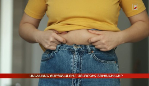 Մանկական ճարպակալում. մտահոգիչ ցուցանիշներ